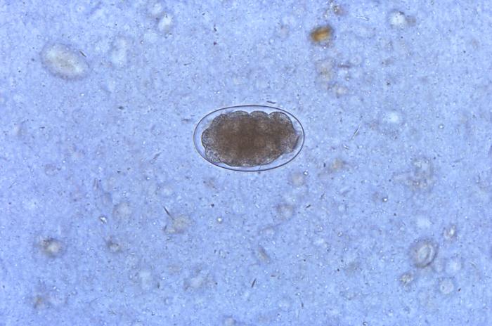  Giun móc (Ancylostoma) ở mèo